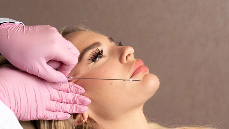 زمان تخلیه نخ لیفت؛ چه زمانی باید اقدام کرد؟